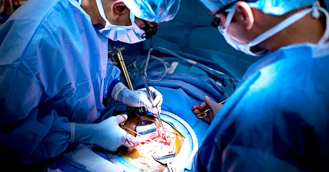 Minimally invasive vascular surgery Mancherial